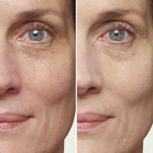 New Sos Primer Green Pre-Bases E Iluminadores